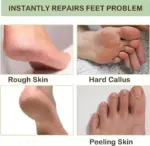 Moisturizing Silicone Gel Socks – Foot Care Spa Socks - Image 3